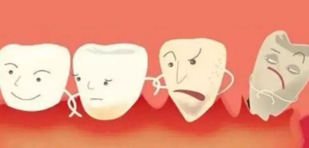 想种个牙,为何还得治疗牙周病? 想种个牙,为何还得治疗牙周病?