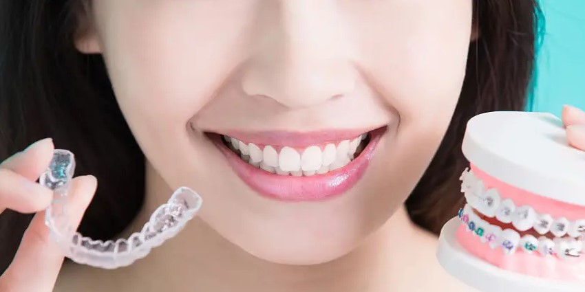 牙齿矫正攻略，请查收！—义乌傅氏口腔