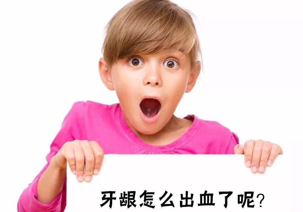 不洗牙,小心牙周炎吃掉你的骨头! 不洗牙,小心牙周炎吃掉你的骨头!