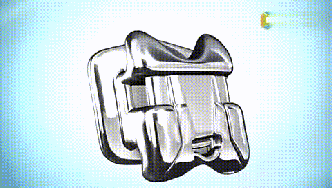 箍牙全过程，牙套是这样戴上去的！—义乌傅氏口腔