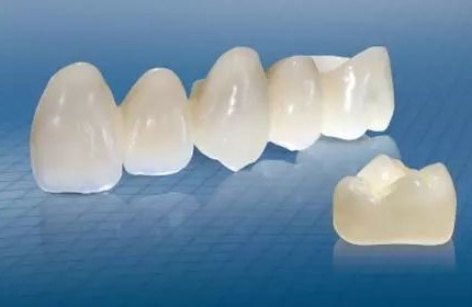 种植牙可以核磁共振吗? 种植牙可以核磁共振吗?