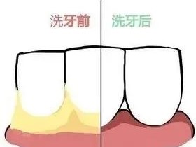 实用口腔小常识，一定有你想要的！