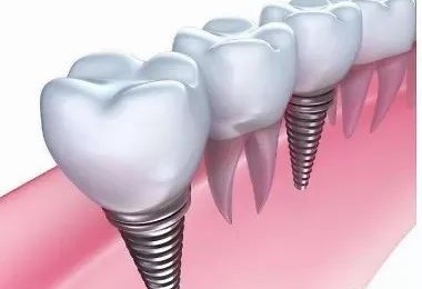 实用口腔小常识，一定有你想要的！