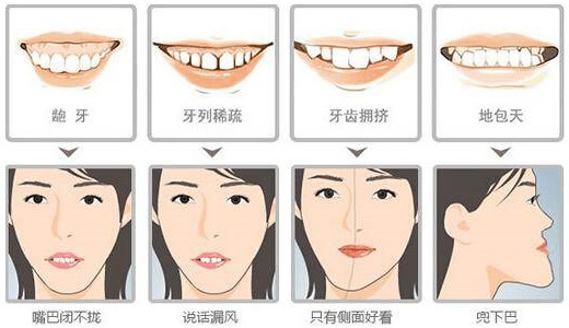 过了矫牙黄金期才去矫正会不会影响效果？