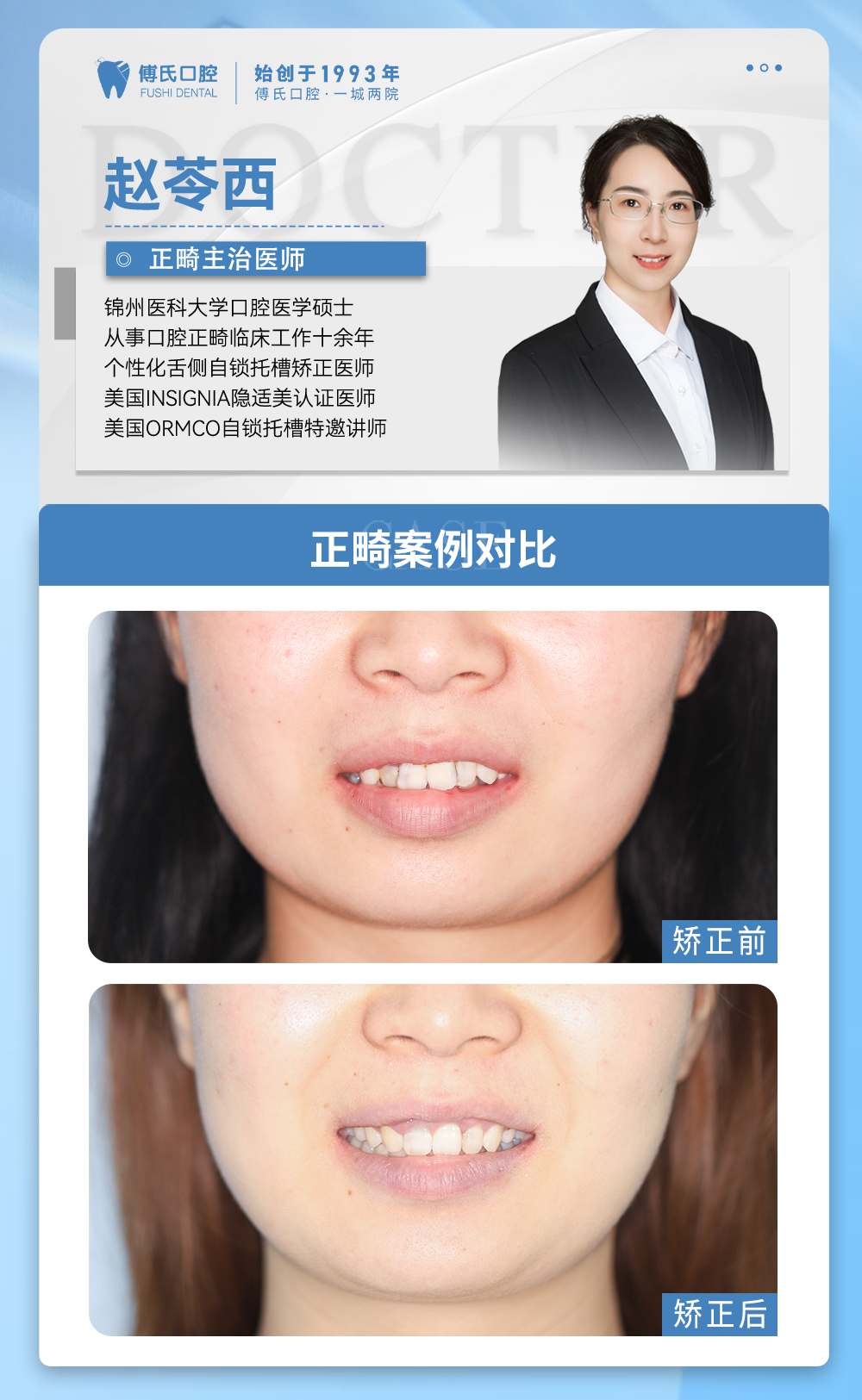 义乌傅氏口腔牙列不齐,下巴后缩矫正案例分享! 义乌傅氏口腔牙列不齐,下巴后缩矫正案例分享!
