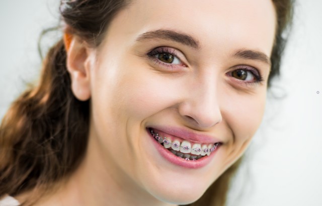 牙齿矫正