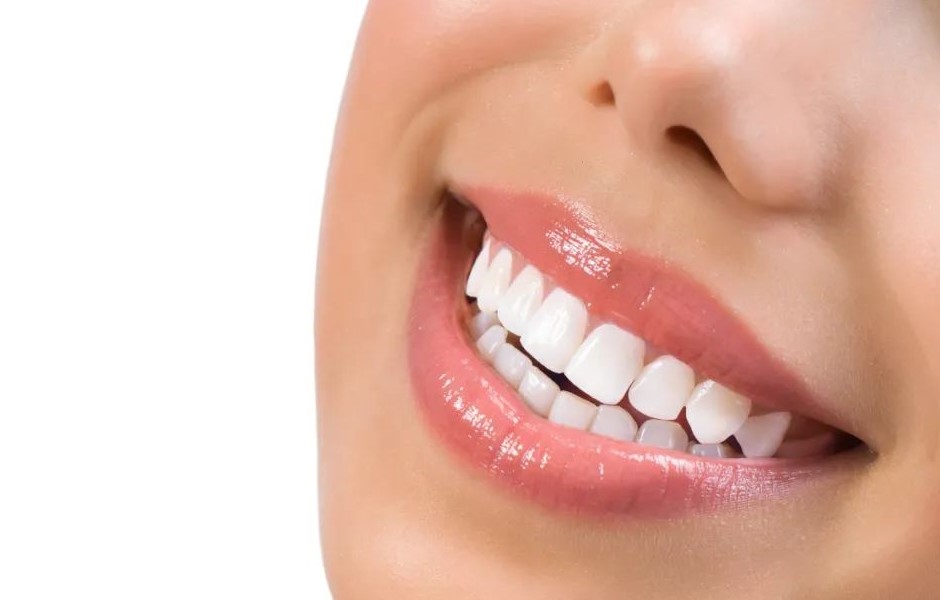 牙齿美白
