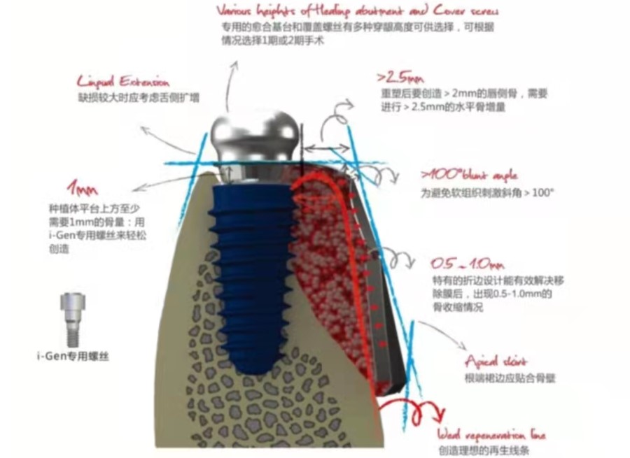 口腔种植还有禁忌症? 口腔种植还有禁忌症?