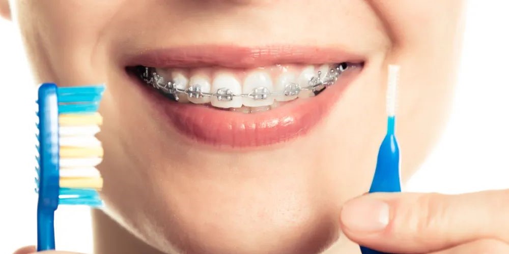 矫正时出现牙齿松动正常吗? 矫正时出现牙齿松动正常吗?