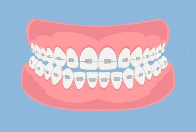 矫正时出现牙齿松动正常吗? 矫正时出现牙齿松动正常吗?