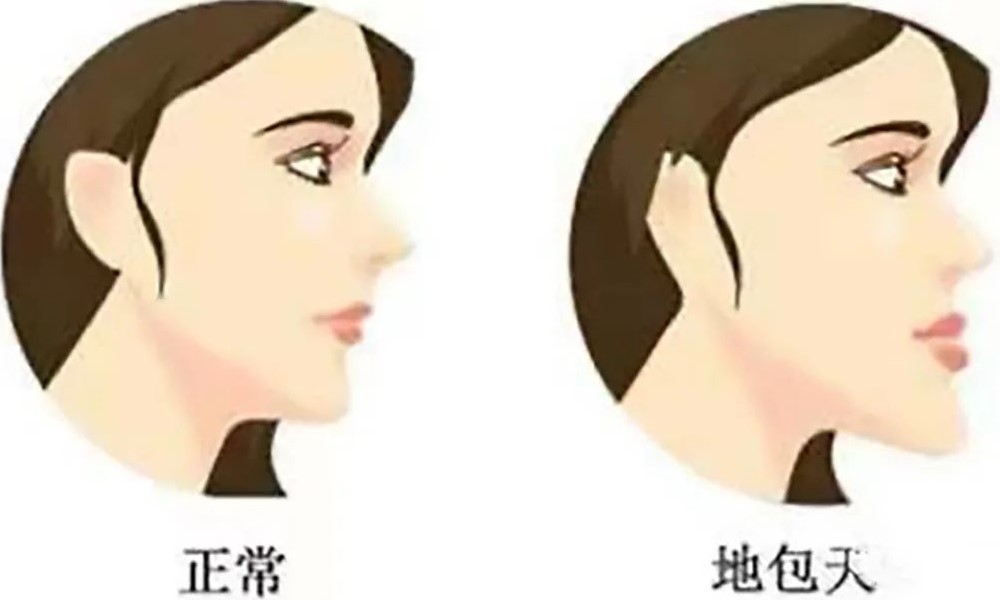 12岁前须处理的儿童牙颌畸形! 12岁前须处理的儿童牙颌畸形!