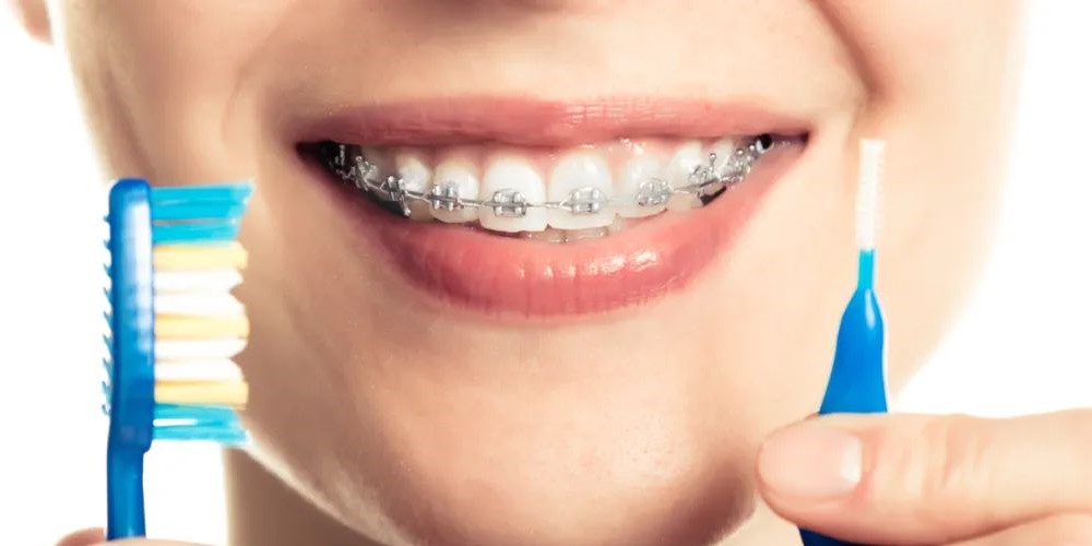 矫正拔牙:三种人必拔,五种人不能拔! 矫正拔牙:三种人必拔,五种人不能拔!