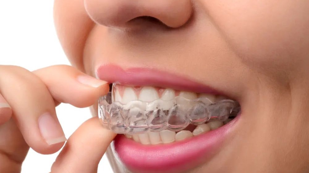 矫正拔牙:三种人必拔,五种人不能拔! 矫正拔牙:三种人必拔,五种人不能拔!