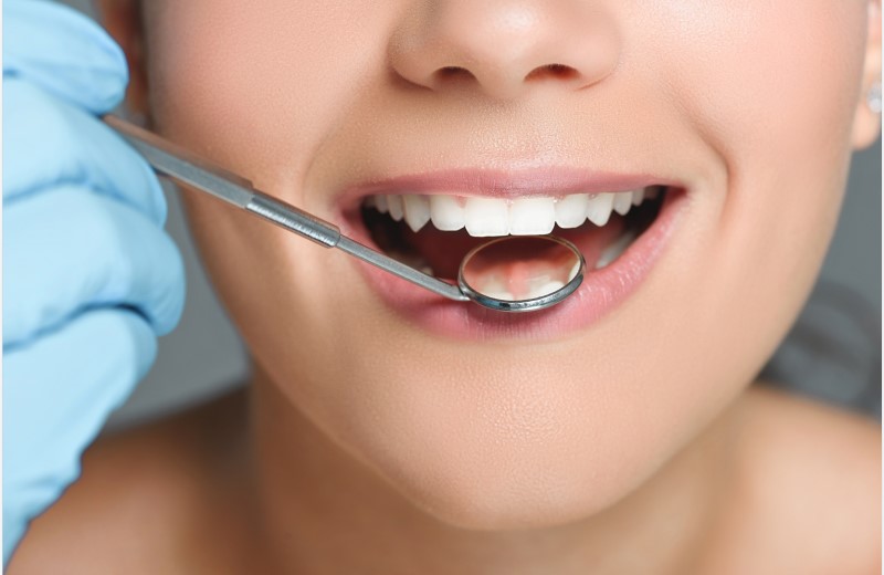 戴过牙套才知道的人生经验！—义乌牙齿矫正