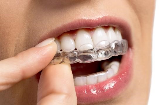 戴过牙套才知道的人生经验！—义乌牙齿矫正