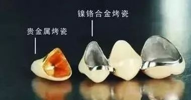 镍铬、钴铬、贵金属和全瓷牙那个好？
