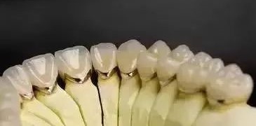 镍铬、钴铬、贵金属和全瓷牙那个好？