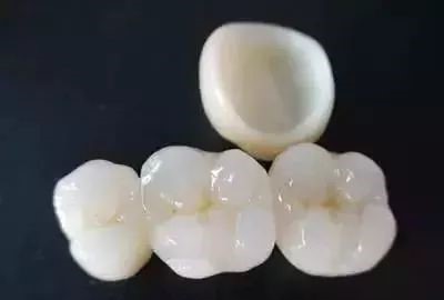 镍铬、钴铬、贵金属和全瓷牙那个好？