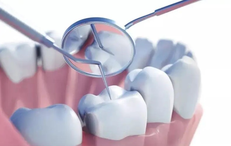 蛀牙特烦恼,不痛补什么? 蛀牙特烦恼,不痛补什么?