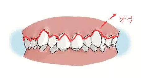 牙齿矫正中的扩弓会让脸变大？