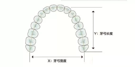 牙齿矫正中的扩弓会让脸变大？