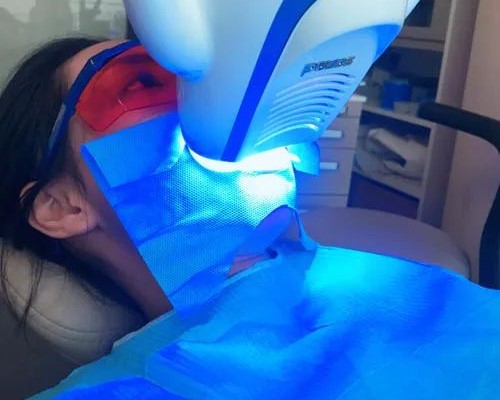 牙齿冷光美白有何好处和优点? 牙齿冷光美白有何好处和优点?