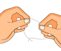 当心邻面龋,一颗坏成两! 当心邻面龋,一颗坏成两!