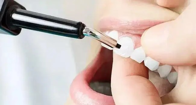 临时牙修复体,可能会忽略的细节! 临时牙修复体,可能会忽略的细节!