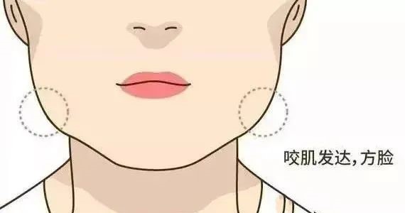 怎样的脸型牙齿矫正后会美上加美？—义乌傅氏口腔