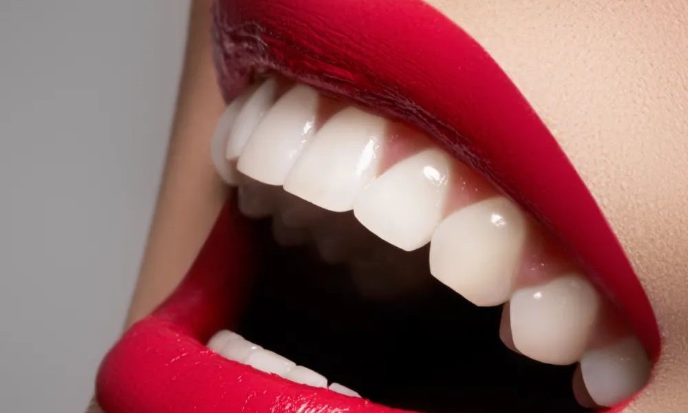 关于牙齿美白,你想知道的十个问题! 关于牙齿美白,你想知道的十个问题!