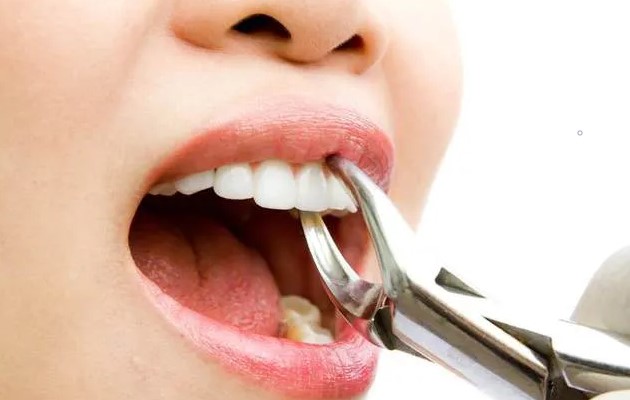女性不宜拔牙的时期！