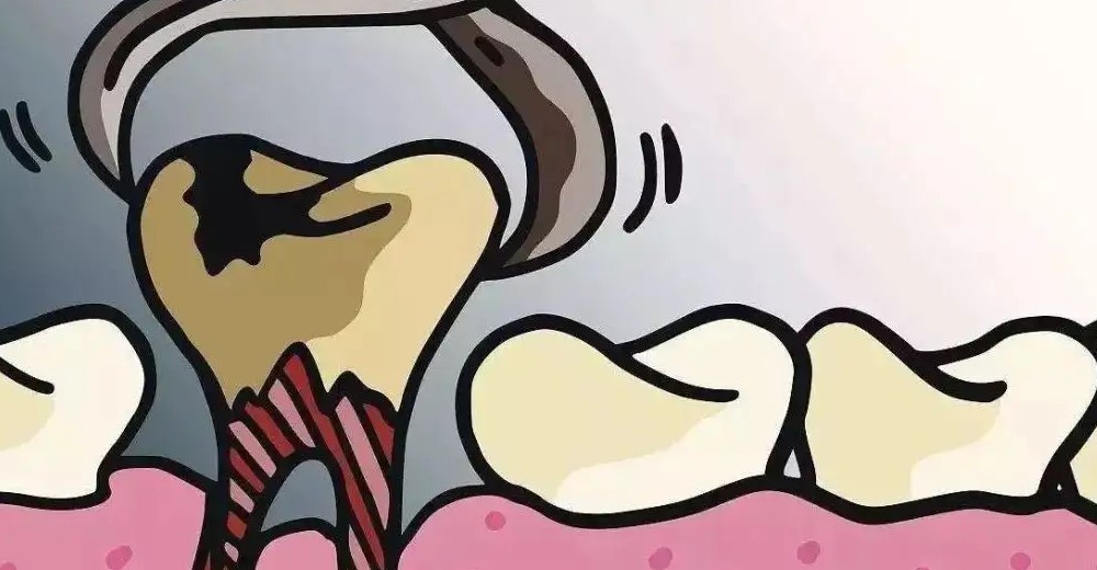 女性不宜拔牙的时期！