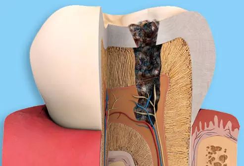 牙齿敏感到底是怎么回事？—义乌傅氏口腔