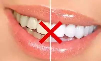 洗牙和牙齿美白是两回事！