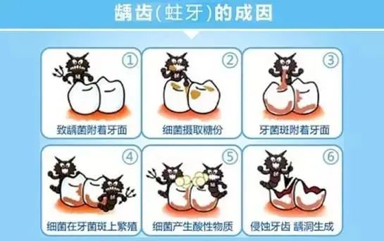 饭后嚼木糖醇,真的可以预防蛀牙吗?—义乌傅氏口腔 饭后嚼木糖醇,真的可以预防蛀牙吗?—义乌傅氏口腔