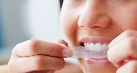 这些美牙“小妙招”你用过吗？