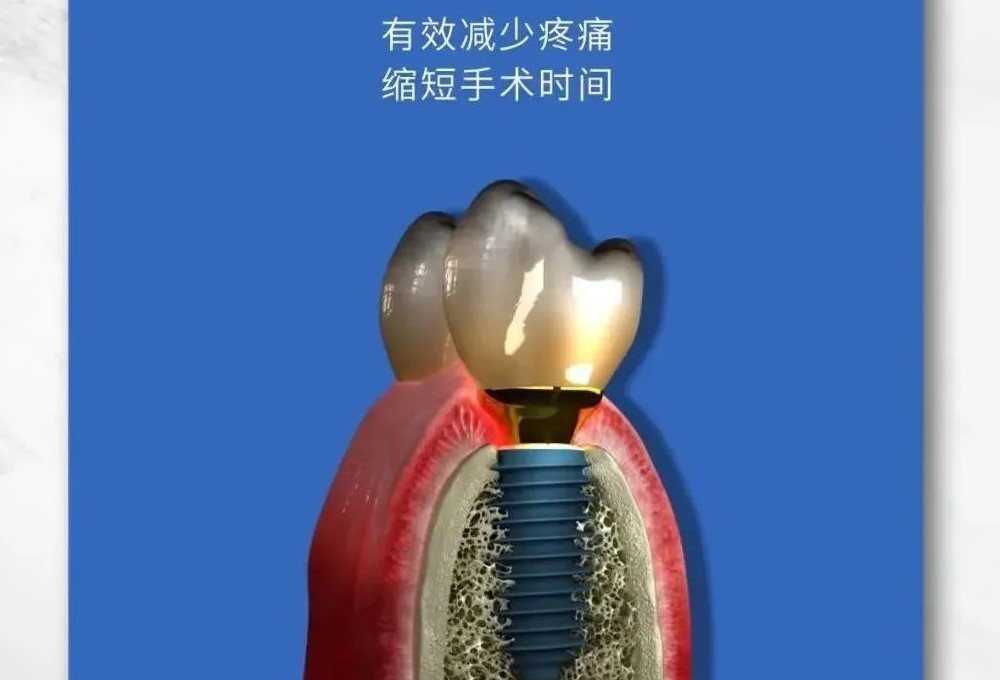 种植牙会和真牙一样坚固耐用吗？