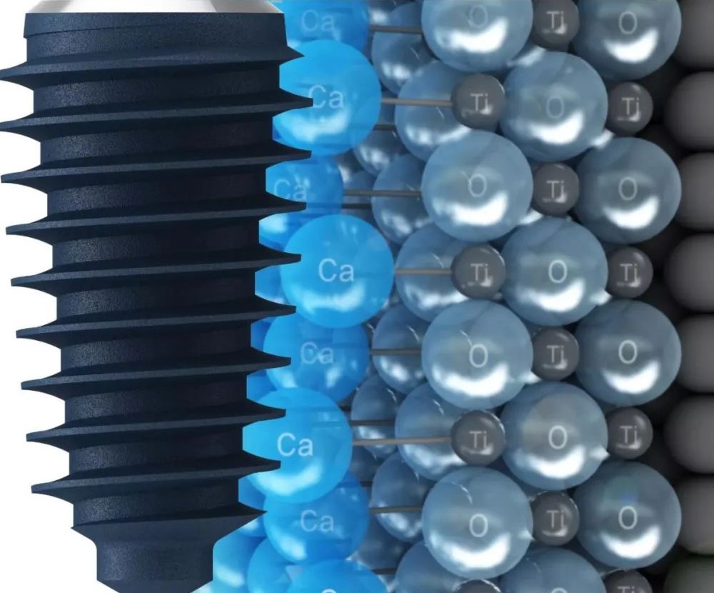 种植牙会和真牙一样坚固耐用吗？