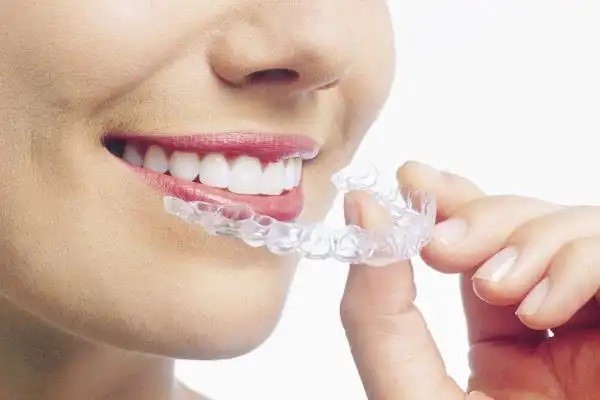 矫正牙齿最大年龄限制是多少？—义乌牙齿矫正