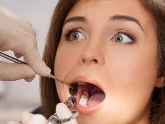 女性拔牙避免这四个时期！