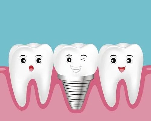 种植牙会与身体产生排斥吗？