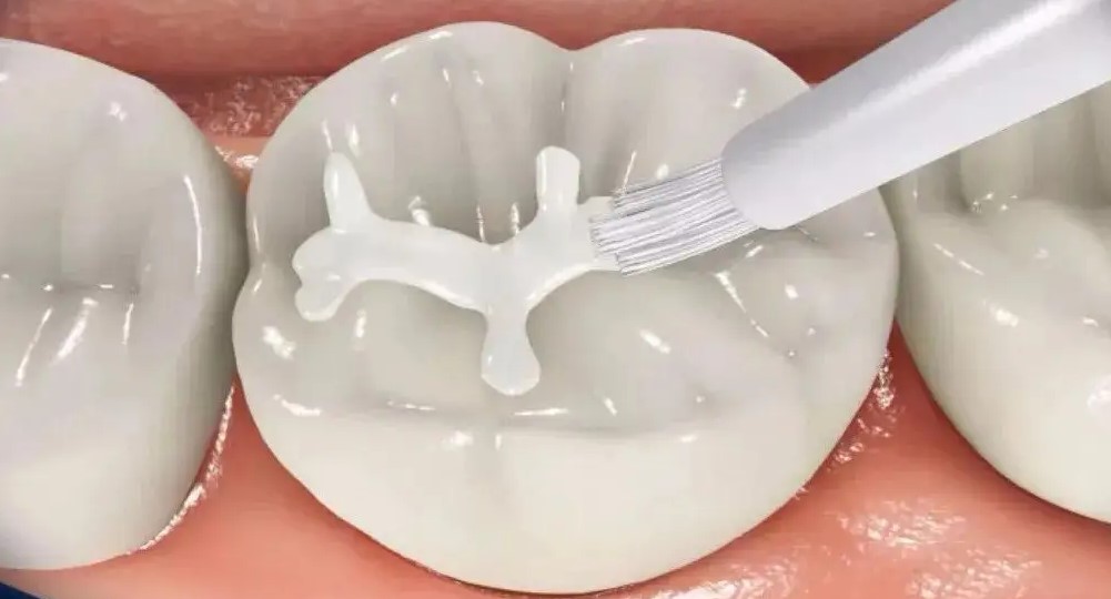 从不喝碳酸饮料,小孩牙齿却被泡腐,罪魁祸首一定喝过! 从不喝碳酸饮料,小孩牙齿却被泡腐,罪魁祸首一定喝过!