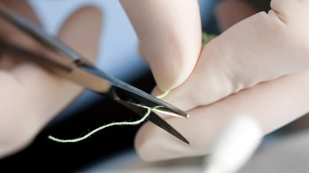 排龈线的选择及排龈方式的设计！