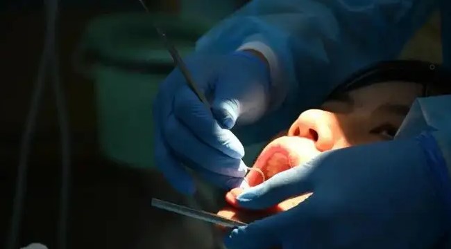 排龈线的选择及排龈方式的设计！