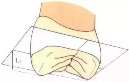 如何把握嵌体与高嵌体？