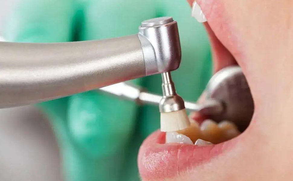 假牙怎么清理？