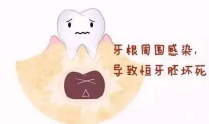 孩子乳牙龋坏怎么办? 孩子乳牙龋坏怎么办?