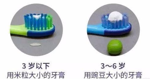 孩子乳牙龋坏怎么办? 孩子乳牙龋坏怎么办?