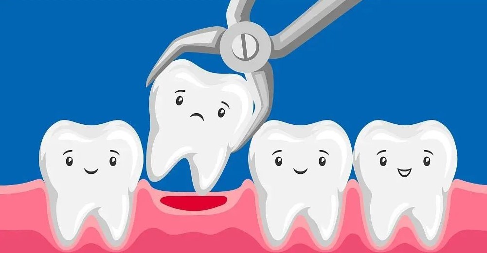 医生,拔牙后发烧是咋回事? 医生,拔牙后发烧是咋回事?