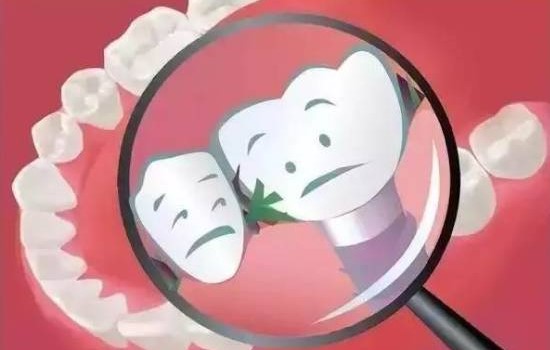 塞牙也是一种病？分享解决方法！